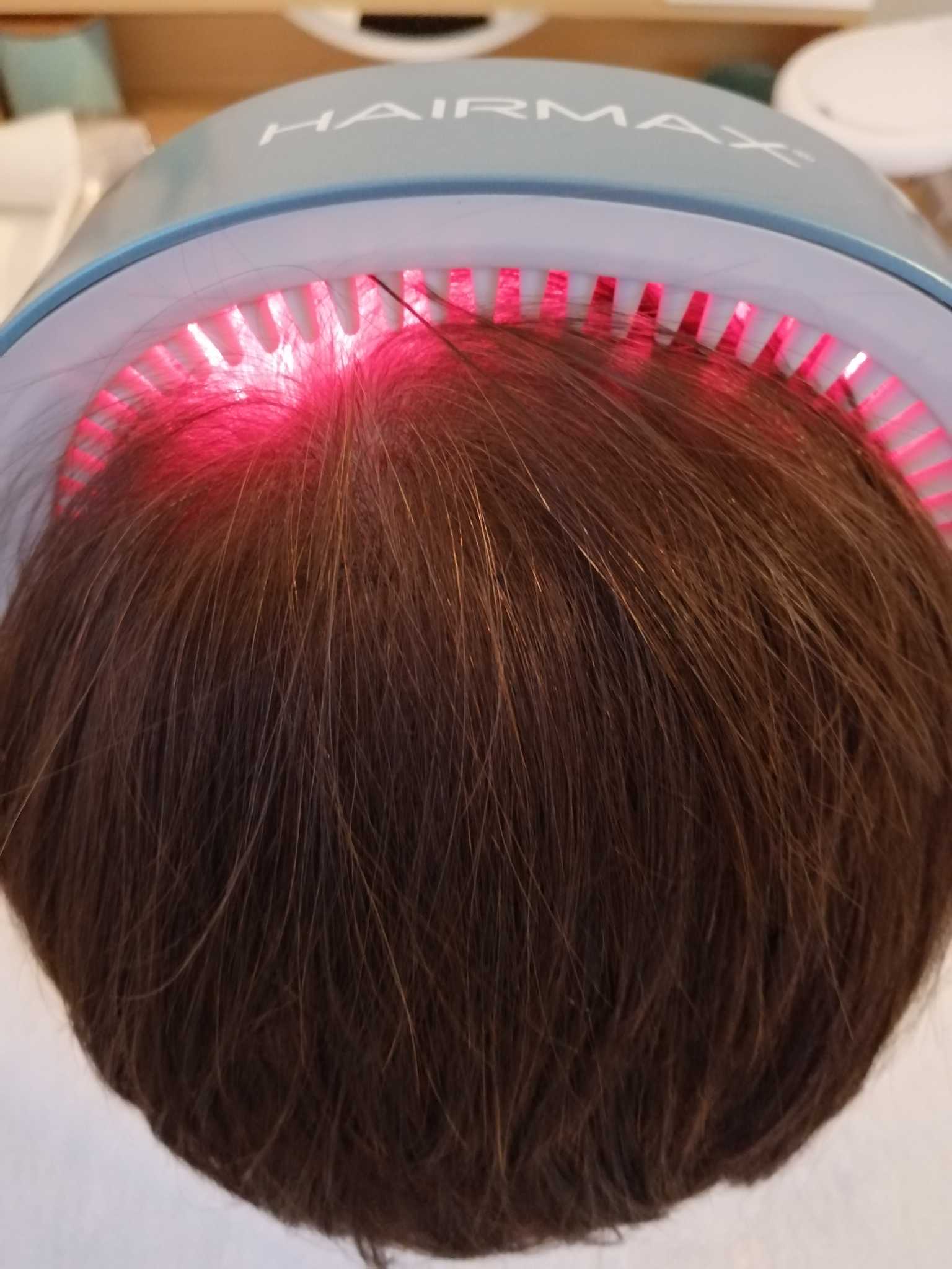 Fototerapia LLLT (ang. Low Level Laser Therapy)